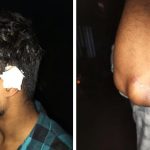 কালিগঞ্জে সমাবেশে যাওয়ার পথে কৃষকদলের গাড়ি বহরে হামলার অভিযোগ
